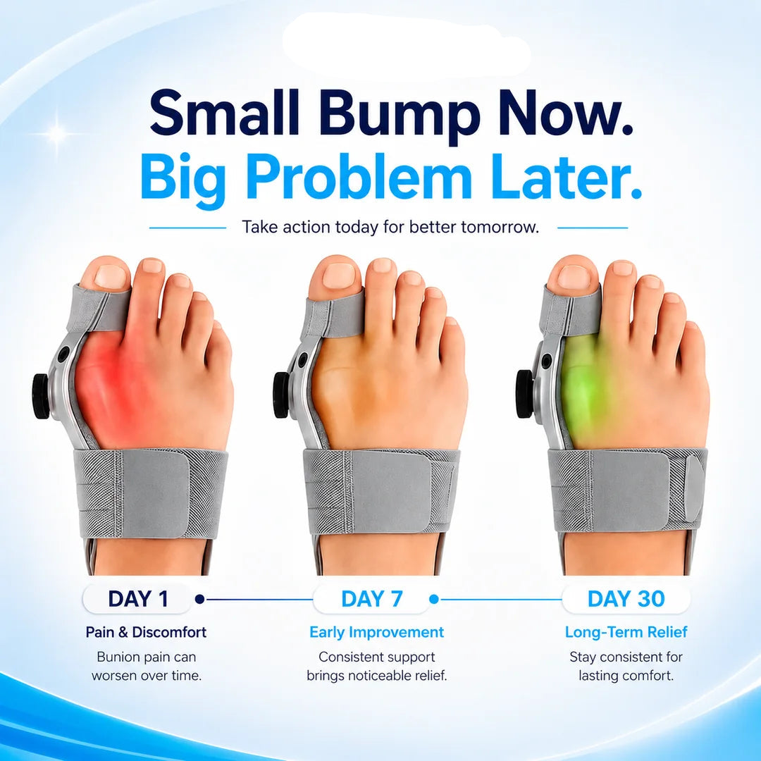 Bunion Corrector and Relief