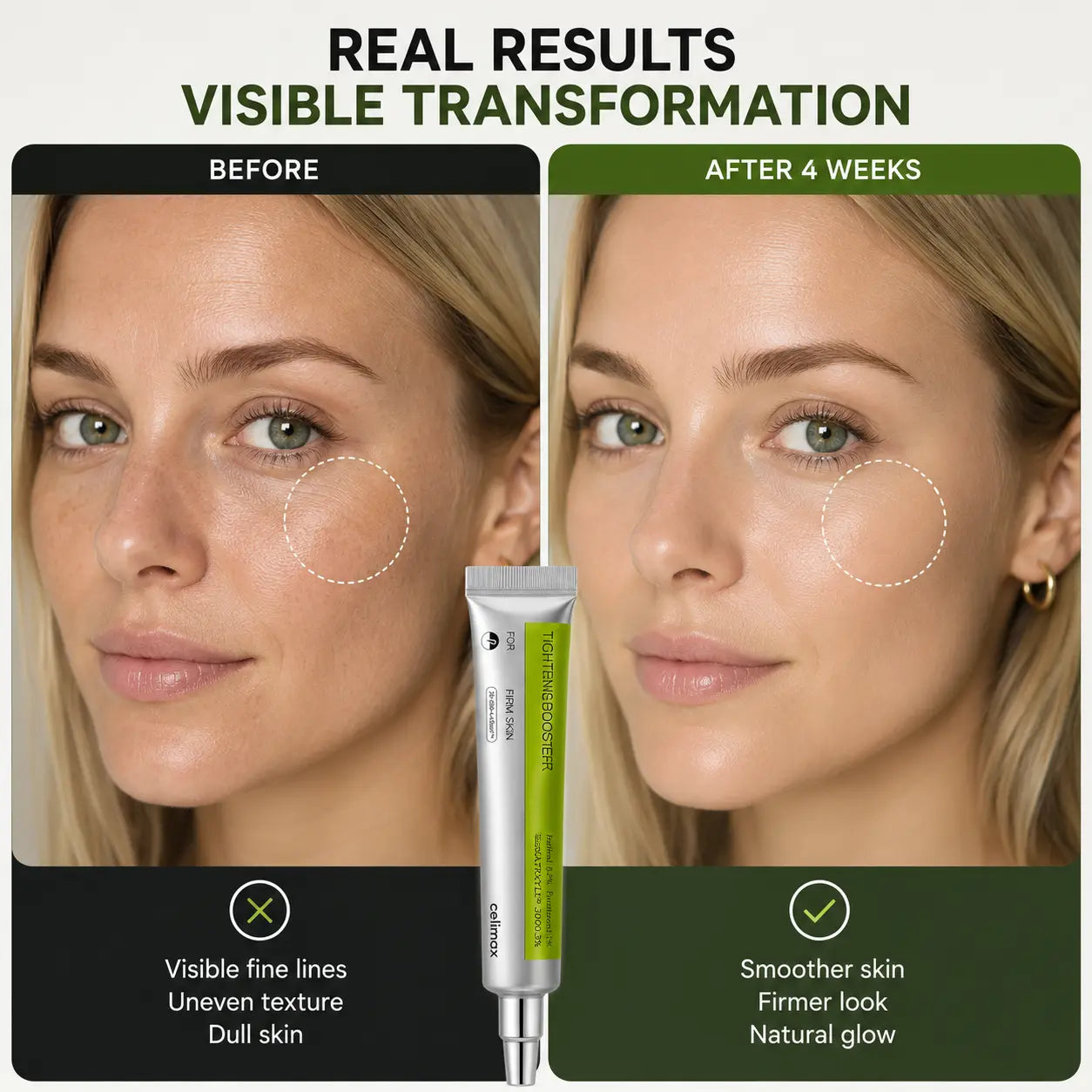Korean Retinal Shot Tightening Booster