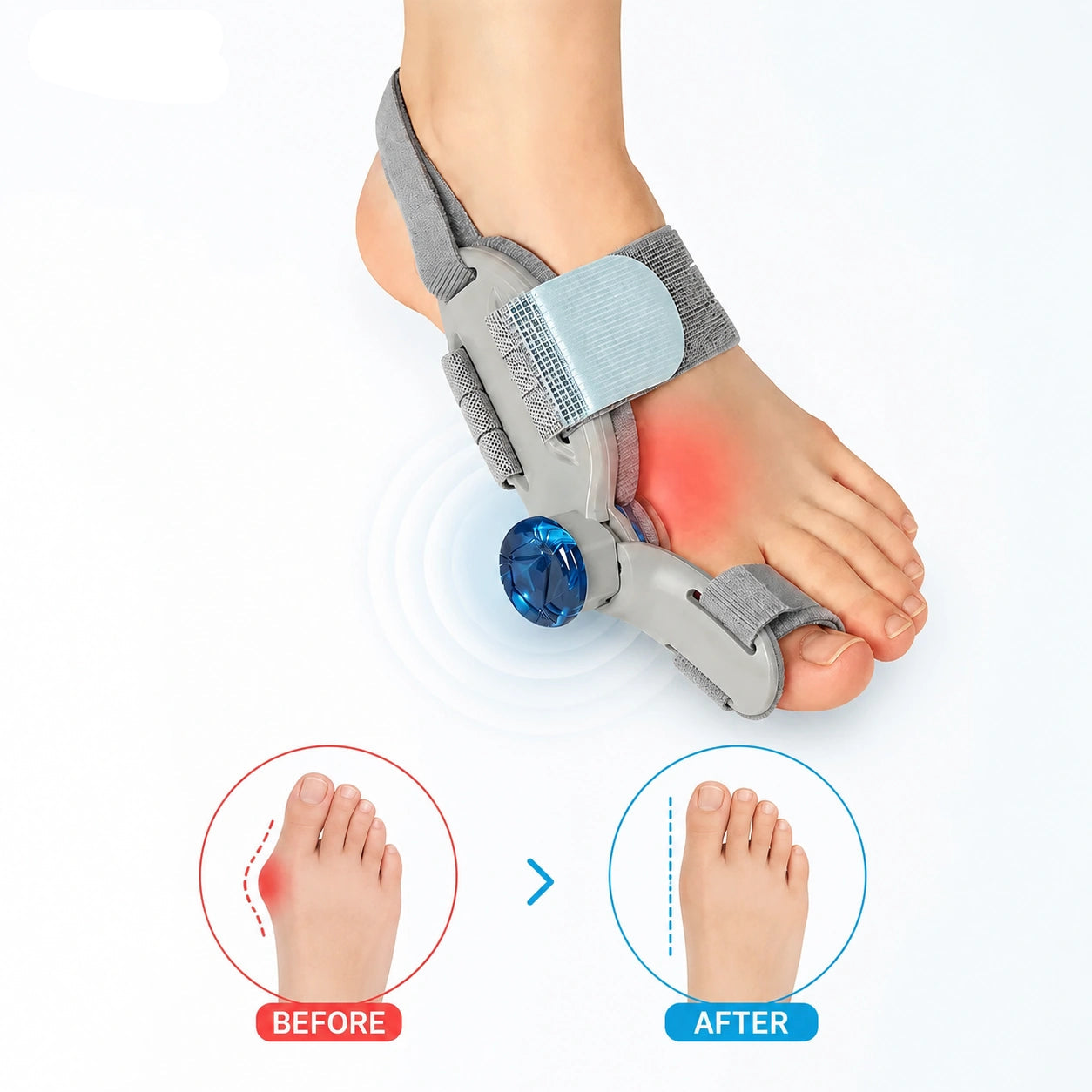 Bunion Corrector and Relief
